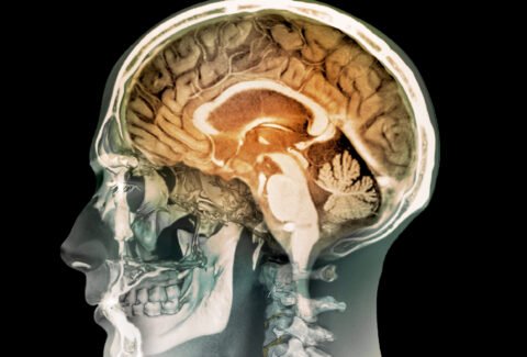 Human head, MRI and 3D CT scans