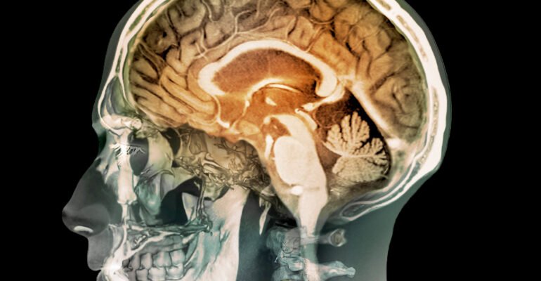 Human head, MRI and 3D CT scans